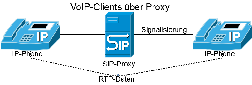  Vereinfachter Aufbau eines VoIP-Netz